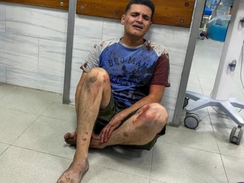 A Palestinian man wounded in an Israeli strike reacts as he sits on the floor at a hospital, in Jabalia, in the northern Gaza Strip on October 5, 2024